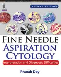Fine Needle Aspiration Cytology: Interpretation and Diagnostic Difficulties|2/e