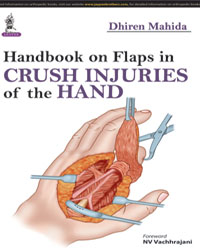 Handbook on Flaps in Crush Injuries of the Hand|1/e