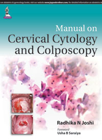 Manual on Cervical Cytology and Colposcopy|1/e