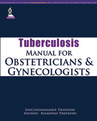 Tuberculosis Manual for Obstetricians and Gynecologists|1/e