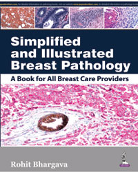 Simplified and Illustrated Breast Pathology: A Book for All Breast Care Providers|1/e