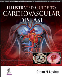 Illustrated Guide to Cardiovascular Disease|1/e