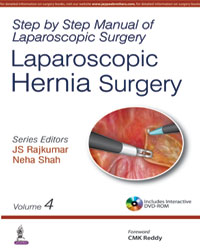 Step by Step Manual of Laparoscopic Hernia Surgery (Volume 4)|1/e