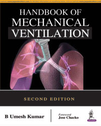 Handbook of Mechanical Ventilation|2/e