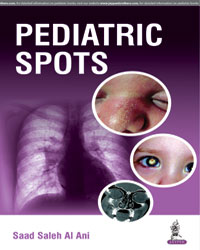 Pediatric Spots|1/e