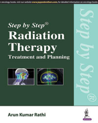 Step by Step Radiation Therapy: Treatment and Planning|1/e