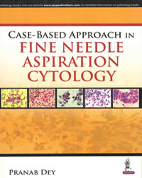 Case-based Approach in Fine Needle Aspiration Cytology|1/e