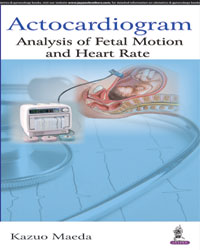 Actocardiogram: Analysis of Fetal Motion and Heart Rate|1/e