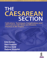 The Caesarean Section|1/e