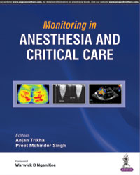 Monitoring in Anesthesia and Critical Care|1/e