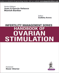 Infertility Management Series: Handbook of Ovarian Stimulation|1/e