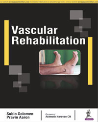 Vascular Rehabilitation|1/e