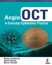 Angio OCT in Everyday Ophthalmic Practice|1/e