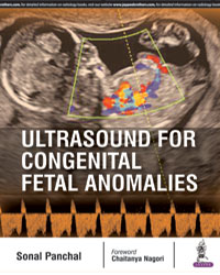 Ultrasound for Congenital Fetal Anomalies|1/e