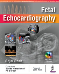 Fetal Echocardiography (Includes CD-ROM)|1/e
