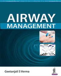 Airway Management|1/e