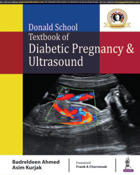 Donald School Textbook of Diabetic Pregnancy and Ultrasound|1/e