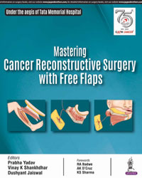 Mastering Cancer Reconstructive Surgery with Free Flaps|1/e