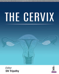 The Cervix|1/e