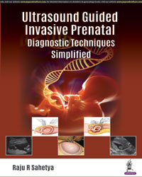 Ultrasound Guided 'Invasive Prenatal Diagnostic Techniques' Simplified|1/e