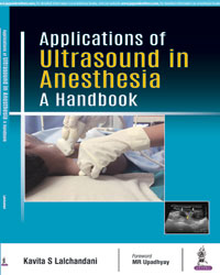 Applications of Ultrasound in Anesthesia: A Handbook|1/e
