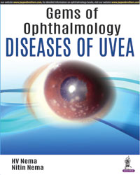 Gems of Ophthalmologyâ€”Diseases of Uvea|1/e
