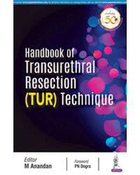 Handbook of Transurethral Resection (TUR) Technique|1/e