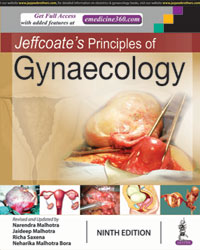 Jeffcoateâ€™s Principles of Gynaecology|9/e