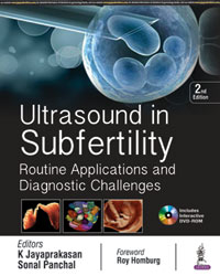 Ultrasound in Subfertility: Routine Applications and Diagnostic Challenges|2/e