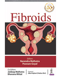 Fibroids|1/e