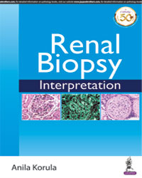 Renal Biopsy Interpretation|1/e