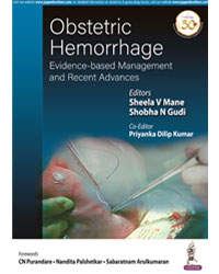 Obstetric Hemorrhage: Evidence-based Management and Recent Advances|1/e