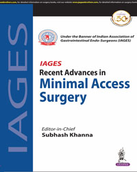 IAGES Recent Advances in Minimal Access Surgery (Under the Banner of Indian Association of Gastrointestinal Endo-Surgeons & Swagat Health & Educational Trust)|1/e