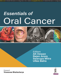 Essentials of Oral Cancer|1/e