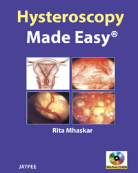 Hysteroscopy Made Easy|1/e