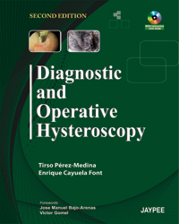 Diagnostic and Operative Hysteroscopy|2/e
