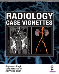 Radiology Case Vignettes|1/e