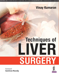 Techniques of Liver Surgery|1/e