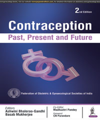 Contraception: Past  Present and Future|2/e