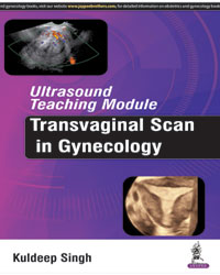Ultrasound Teaching Module: Transvaginal Scan in Gynecology|1/e
