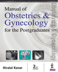 Manual of Obstetrics and Gynecology for the Postgraduates (Previously known as Master Pass in Obstetrics and Gynaecology)|2/e
