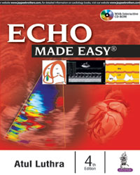 Echo Made Easy (With Interactive CD-ROM)|4/e