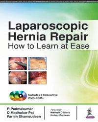 Laparoscopic Hernia Repair â€” How to Learn at Ease (Includes 2 Interactive DVD-ROMs)|1/e