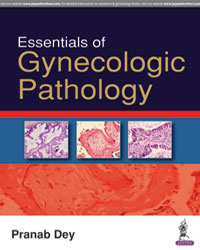 Essentials of Gynecologic Pathology|1/e