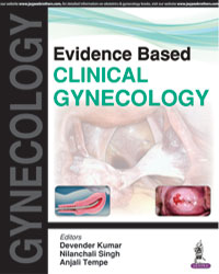 Evidence Based Clinical Gynecology|1/e