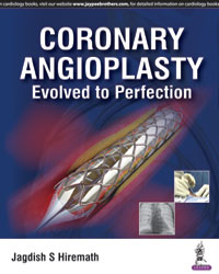 Coronary Angioplasty: Evolved to Perfection|1/e
