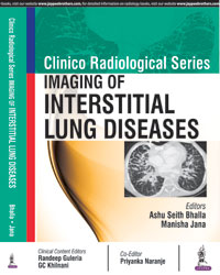 Clinico Radiological Series: Imaging of Interstitial Lung Diseases|1/e