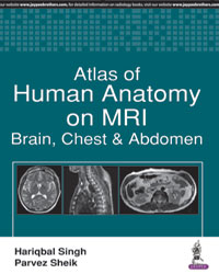 Atlas of Human Anatomy on MRI: Brain  Chest and Abdomen|1/e