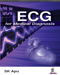 ECG for Medical Diagnosis|1/e