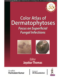 Color Atlas of Dermatophytoses: Focus on Superficial Fungal Infections|1/e